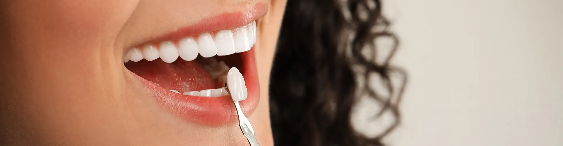 gloved hand holding tooth-shade-matching tool against woman's smile