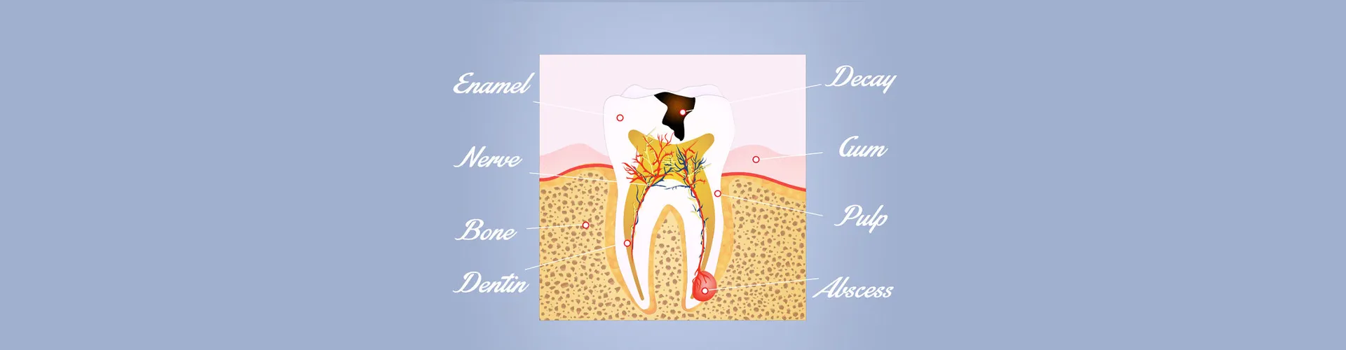 Illustration of a bad teeth