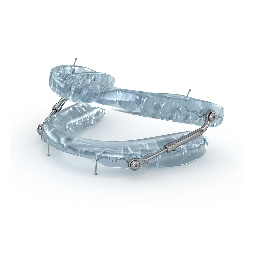 A detailed 3D illustration of transparent dental retainers opened wide, showing the intricate metal hinges and adjustment mechanisms.