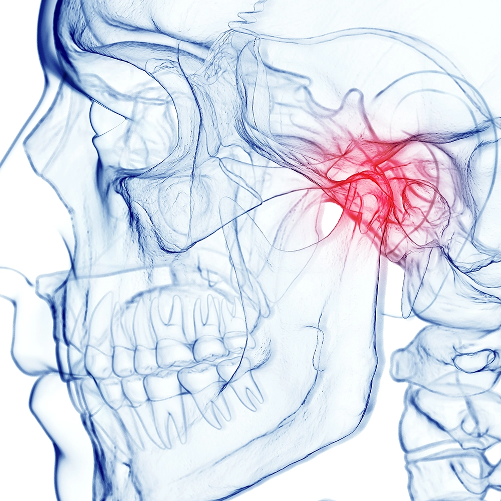 A 3D X-ray image focusing on a human skull's jaw and nasal area, highlighting the bones and sinus cavities with blue and red tints indicating areas of interest.