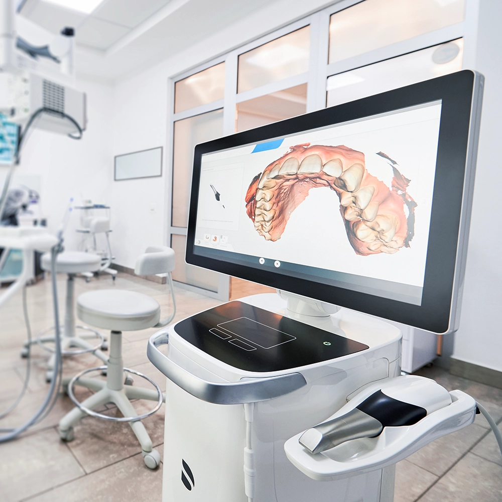 A high-tech dental office featuring a digital impression system on a sleek monitor, displaying a 3D scan of teeth. The equipment is modern and sophisticated, indicating the use of cutting-edge technology in dental treatments at Vartanian Dental Group.