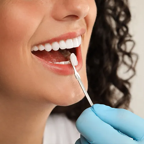 gloved hand holding tooth-shade-matching tool against woman's smile