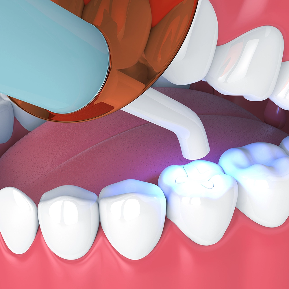 3D illustration of a close-up of a dental light focusing on a patient's teeth during a dental procedure, highlighting dental work